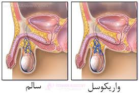 معجون واریکوسل وارداتی/طب سنتی هندی ایرانی با 60گرم ژل رویال
