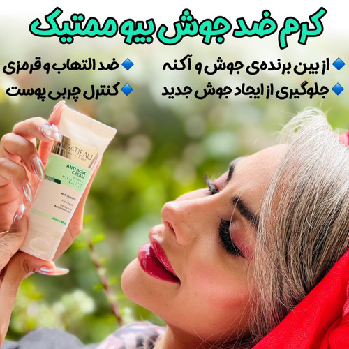 قویترین کرم ژلی ضد جوش و ضد لک برند گاتیو اصل ایتالیا رفع جای جوش/ابرسان/ضد لک مستقیم از نمایندگی حجم 40 میل