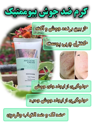 کرم ژلی ضد جوش و ضد لک برند گاتیو اصل ایتالیا رفع جای جوش/ابرسان/ضد لک حجم 40 میل